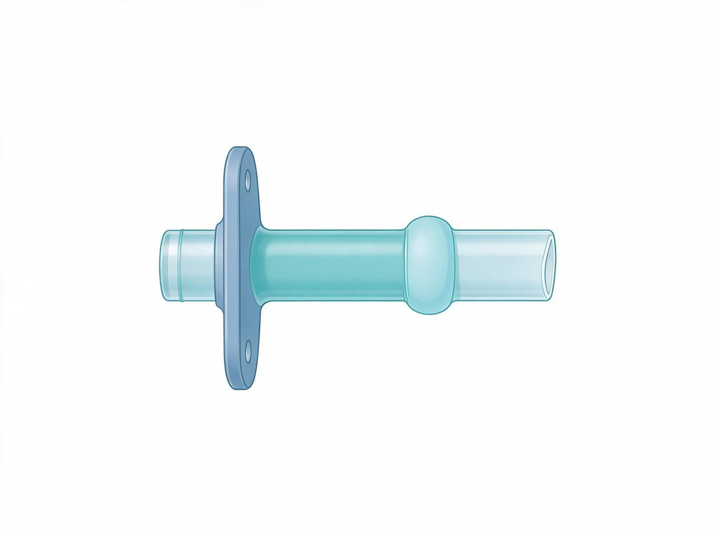 Tracheostomy tube illustration (illustrative)